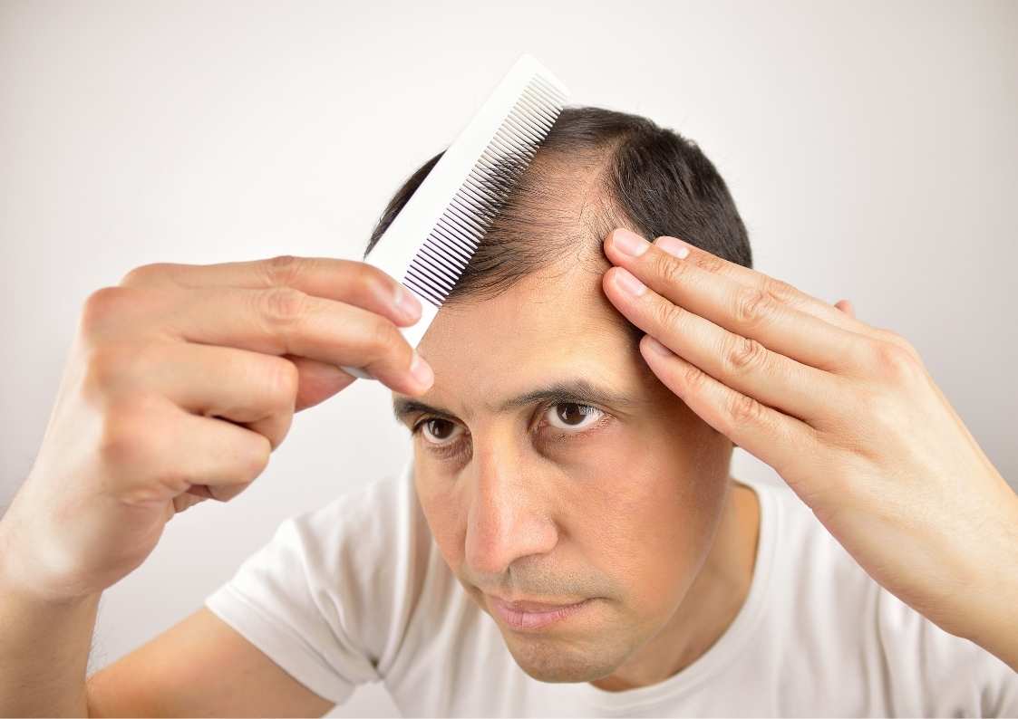 מפרופסיה ועד תרופות סבתא: שיטות הצמחת שיער - כל מה שצריך לדעת